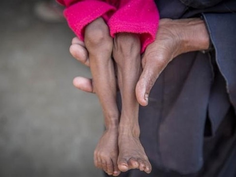 85,000 niños muertos por hambre en Yemen