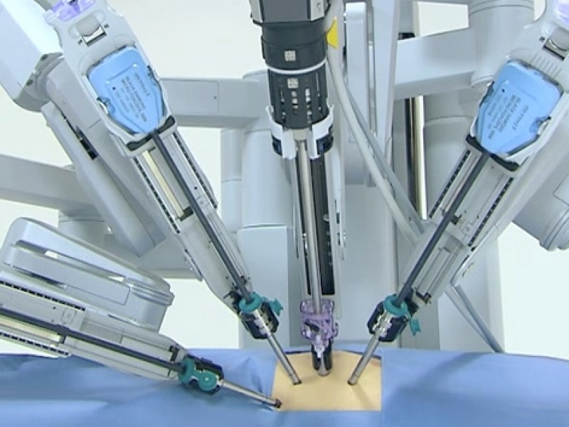 Cirugía robótica, técnica eficiente en operaciones riesgosas
