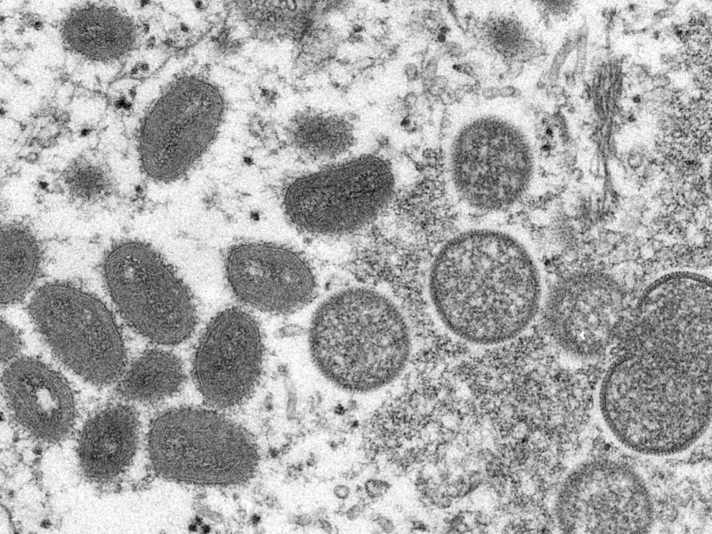 OMS confirma más de cinco mil infecciones de viruela símica