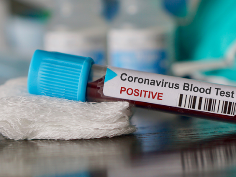 Se eleva a 1115 el número de muertos por Coronavirus
